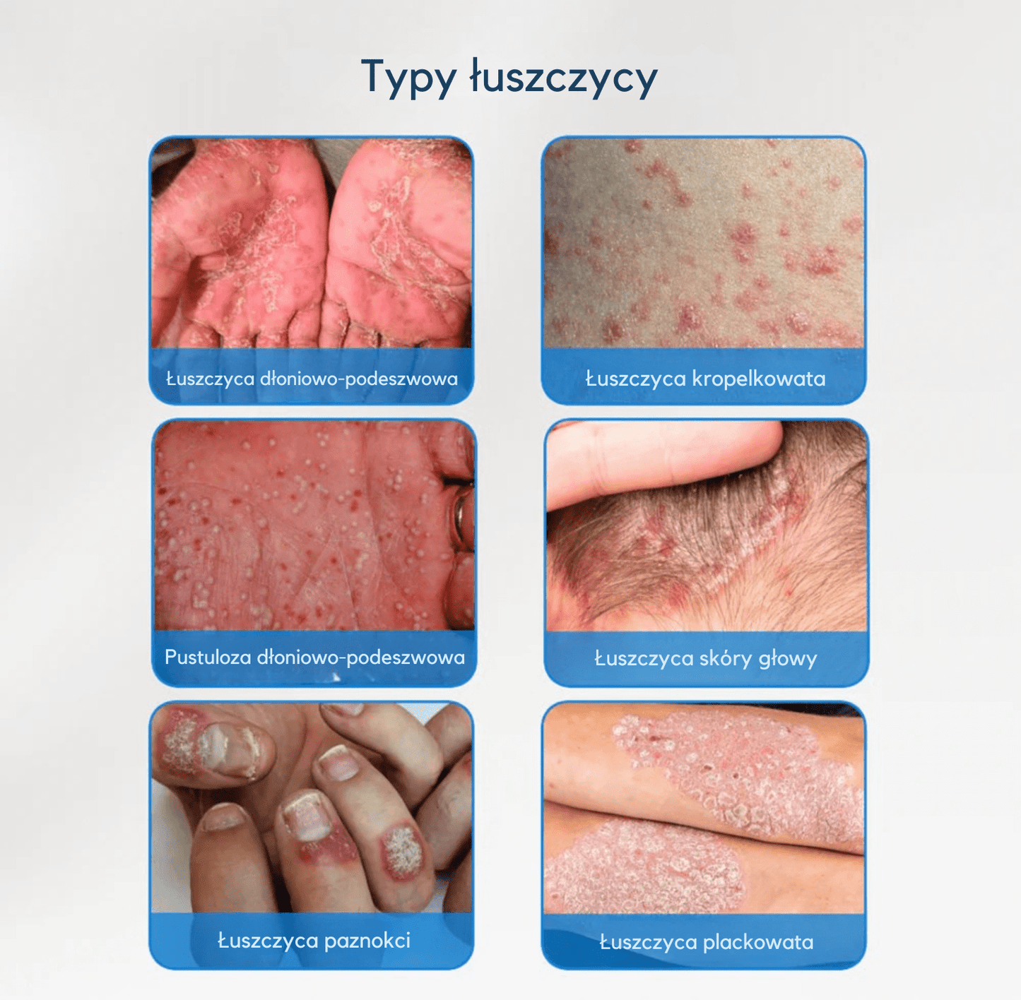 Krem Velyna® ⎜ Dla miękkiej i ukojonej skóry głowy oraz skóry