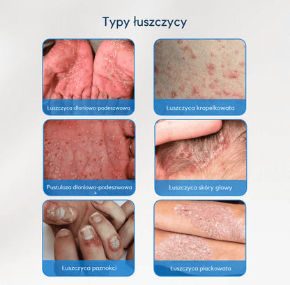 Krem Velyna® ⎜ Dla miękkiej i ukojonej skóry głowy oraz skóry